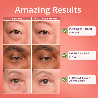 Venus Glitz | Instant Eye Tightener